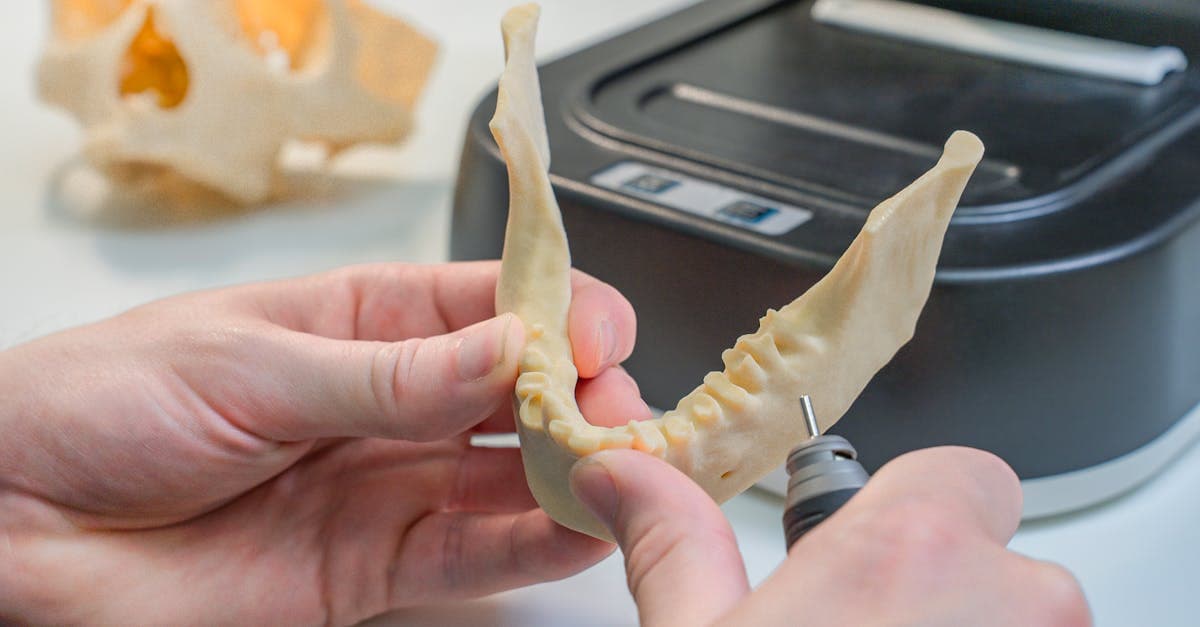 Cover Image for Dental Implant Trials: New Trends Shaping Smiles Today