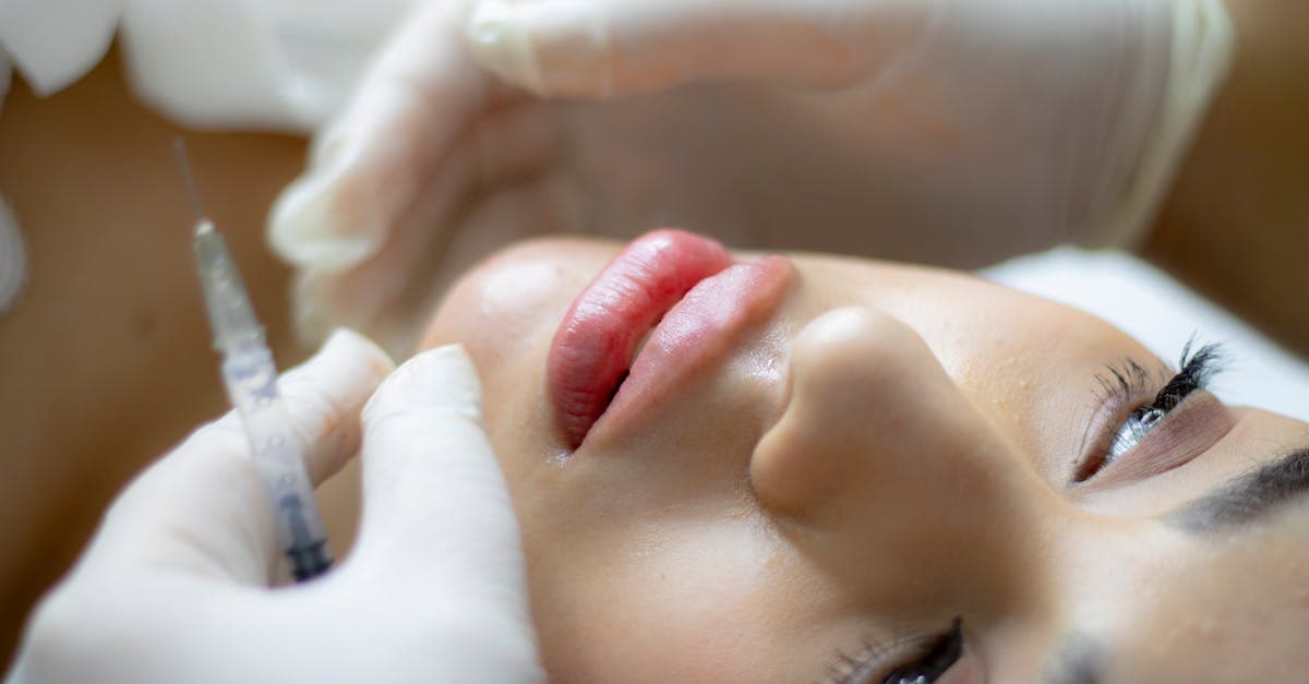 Cover Image for Lip Fillers in 2026: Trends, Safety Tips & New Looks