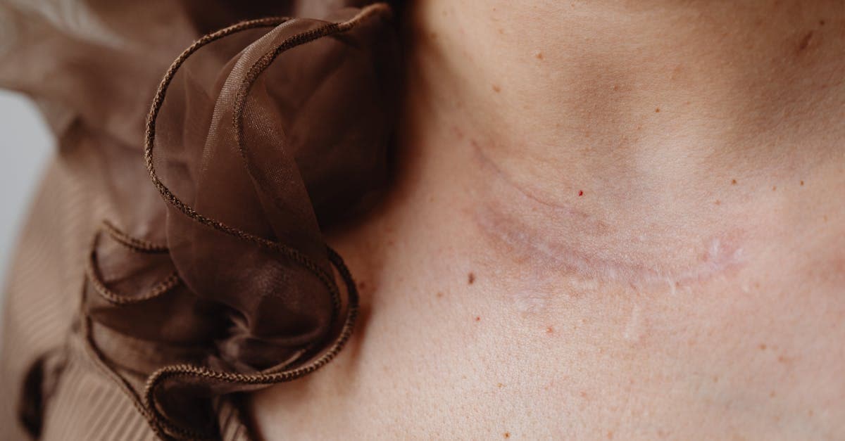 Cover Image for Scar Removal Trends: What Actually Works Today